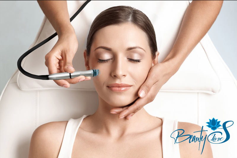 Microdermabraziunea facială